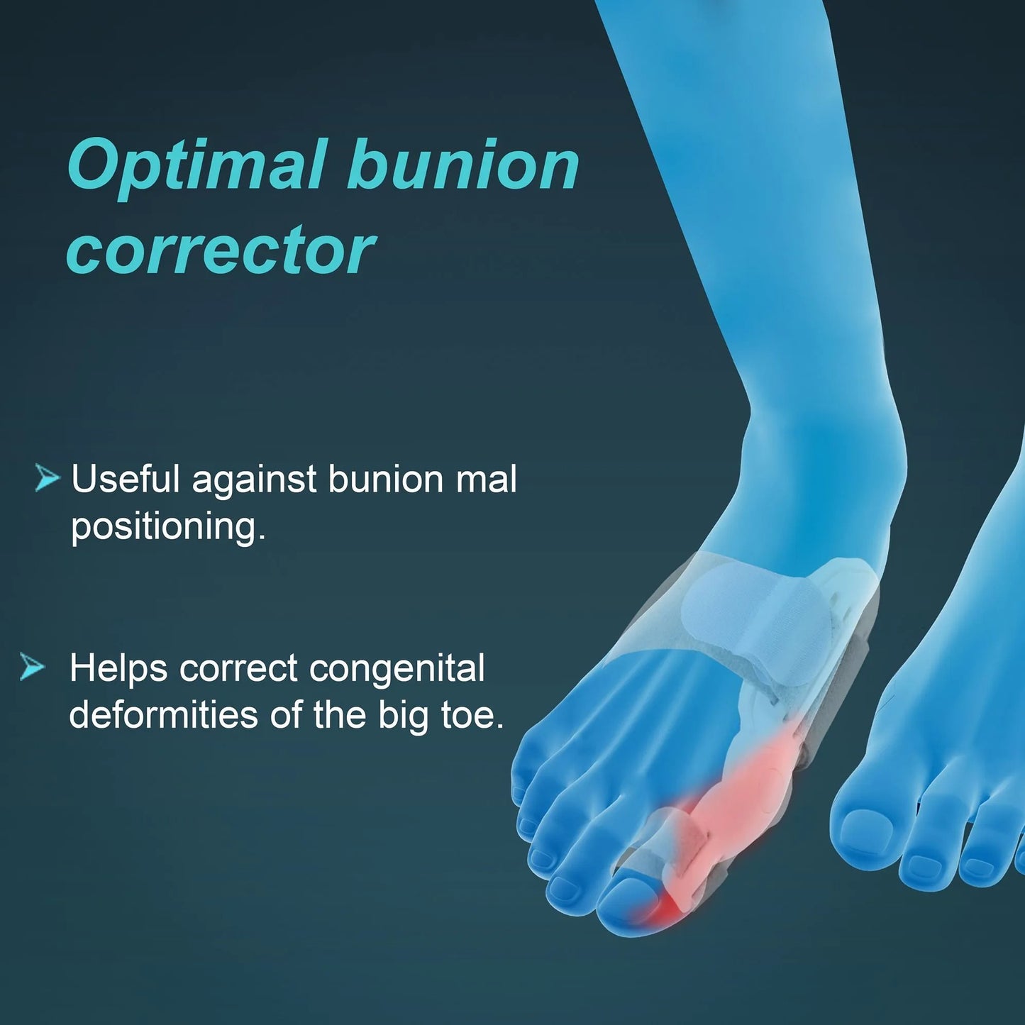 Tynor K14 Bunion Splint