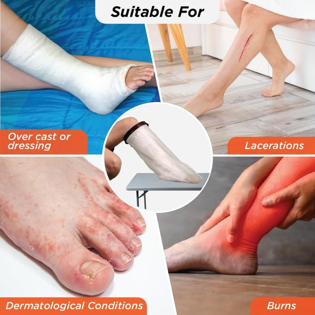 Vissco 0829 Cast Cover - Knee Length