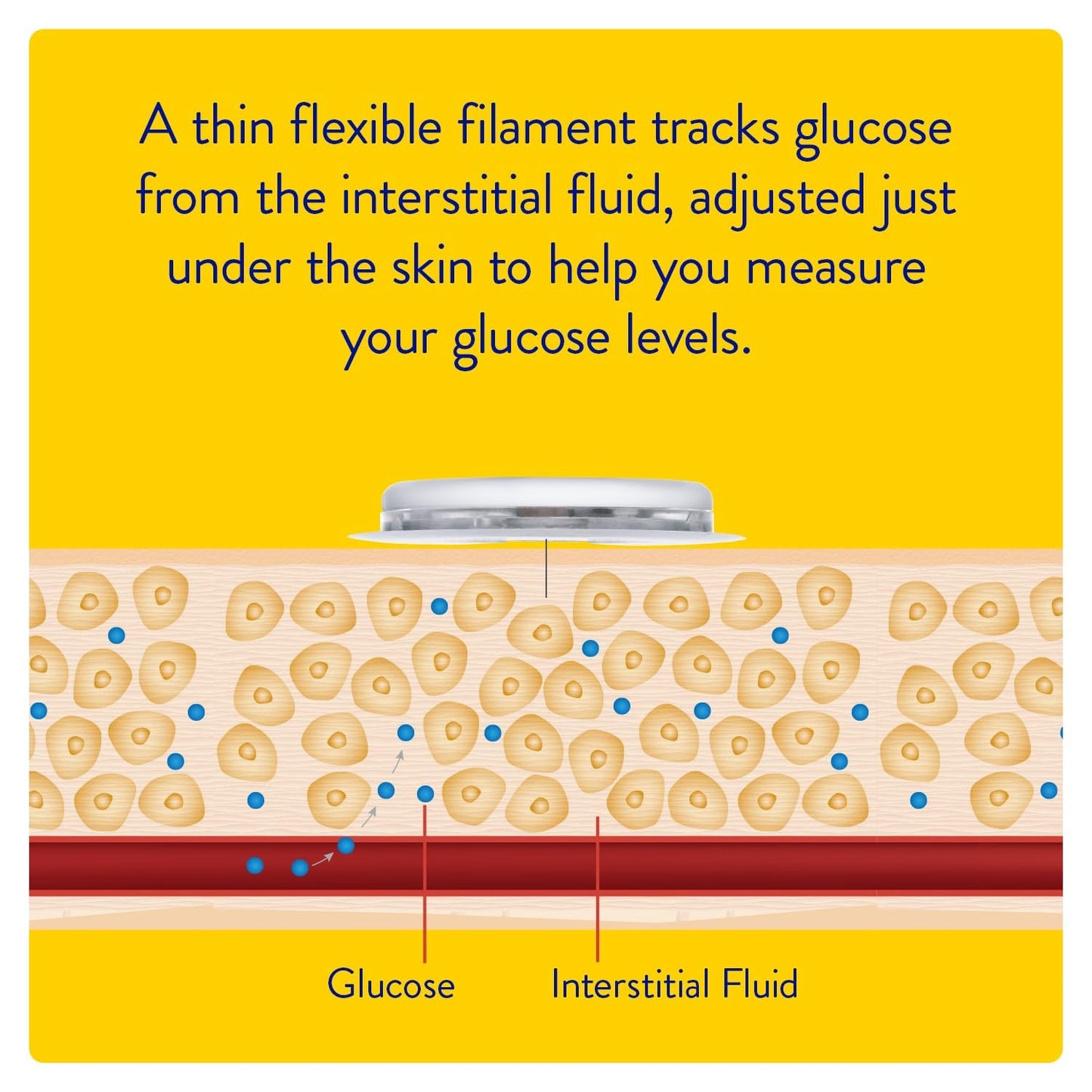 Abbott | FreeStyle Libre CGM Sensor | A Smart Alternative to Traditional Glucose Monitoring | Continuous Glucose Tracking Day & Night | Helps with Better Diabetes Management | No Finger Pricks Required1 | Pack of 2