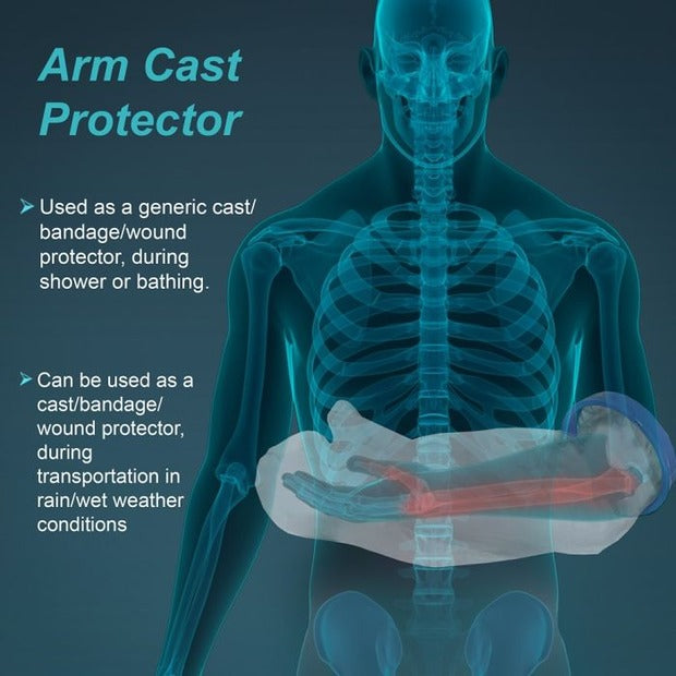 Tynor C19 Cast Cover Arm