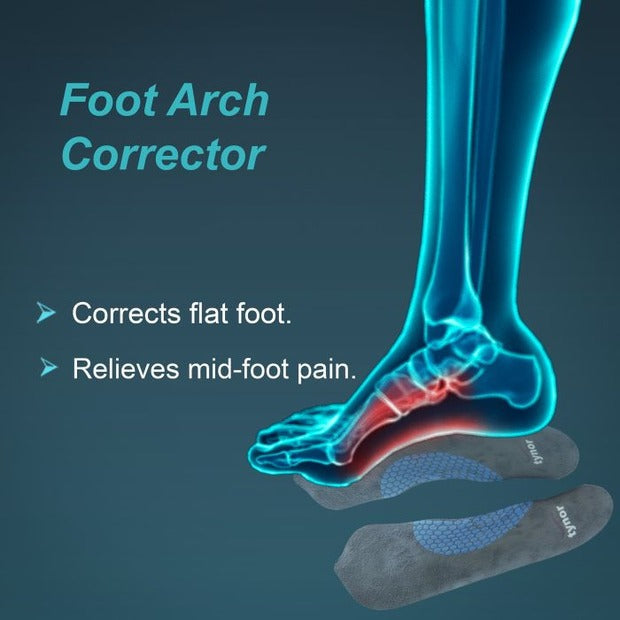 Tynor K11 Medial Arch Orthosis