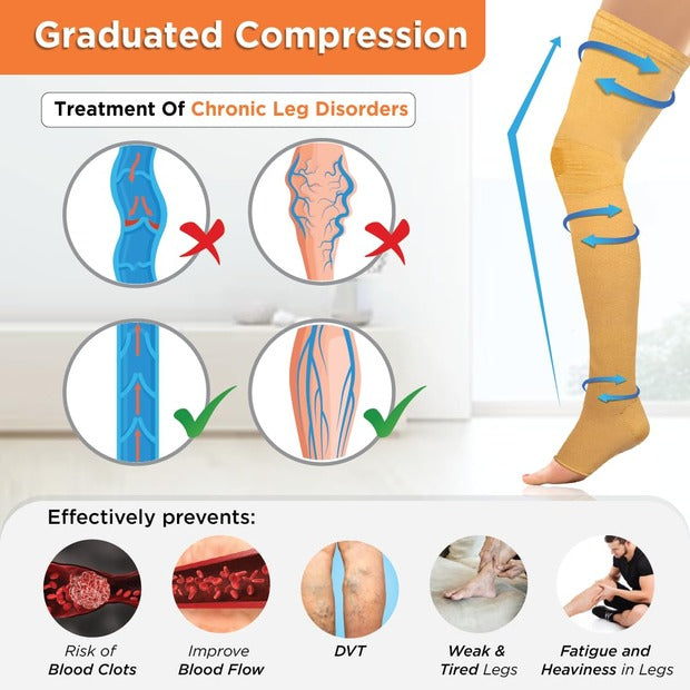 Vissco 0719 Medical Compression Stockings (Above Knee)